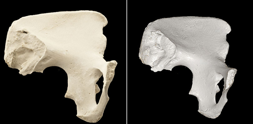 CT scan of a pelvic bone with cinematic rendering and traditional volume rendering