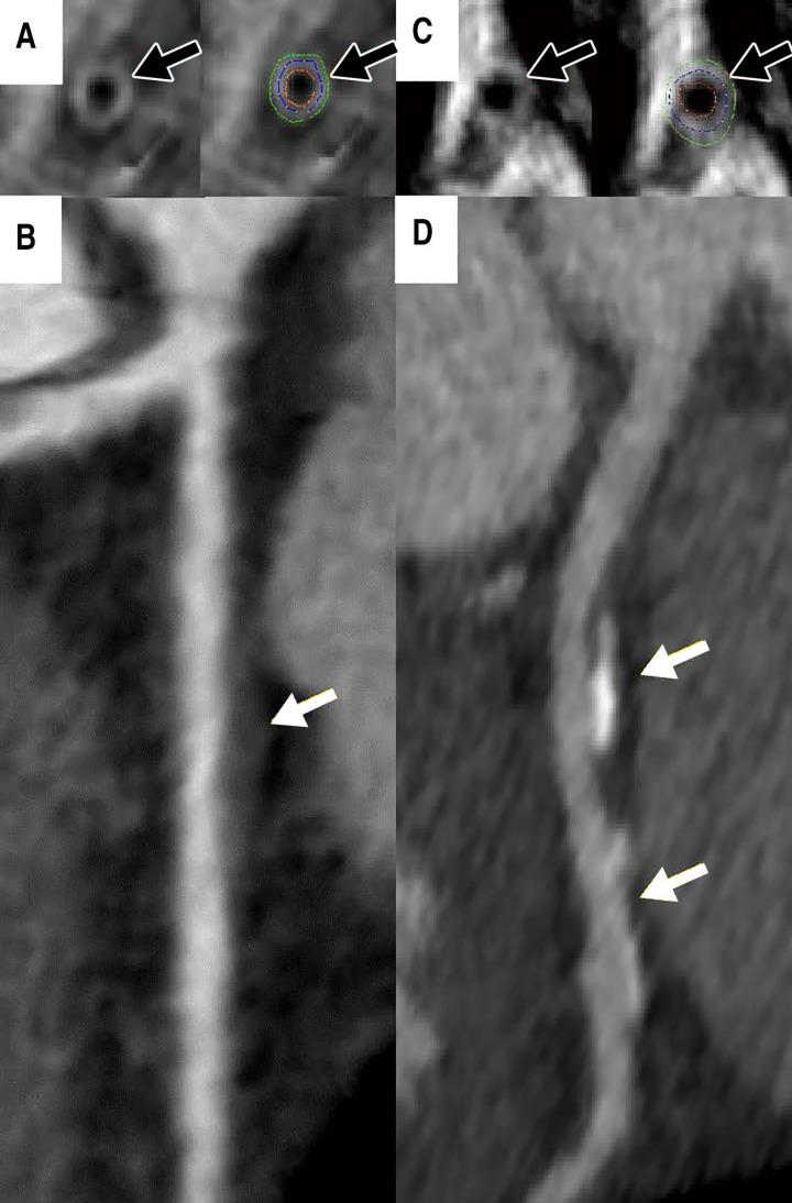 Cardiac MRI and CT angiography images